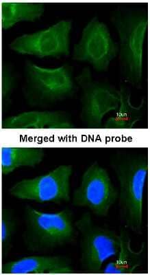 Immunocytochemistry/ Immunofluorescence: GOLGA3 Antibody [NBP1-30963]