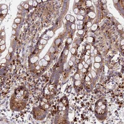 Immunohistochemistry-Paraffin: GOLGA3 Antibody [NBP1-91952]