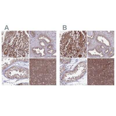 Immunohistochemistry-Paraffin: GOLGA3 Antibody [NBP1-91952]