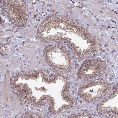 Immunohistochemistry-Paraffin: GOLGA3 Antibody [NBP1-91952]