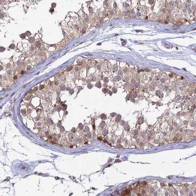 Immunohistochemistry-Paraffin: GOLGA3 Antibody [NBP1-91952]