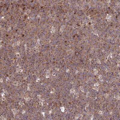 Immunohistochemistry-Paraffin: GOLGA3 Antibody [NBP1-91952]