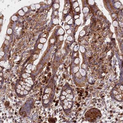 Immunohistochemistry-Paraffin: GOLGA3 Antibody [NBP1-91953]