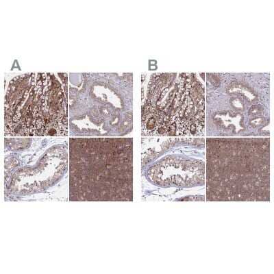 Immunohistochemistry-Paraffin: GOLGA3 Antibody [NBP1-91953]