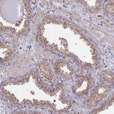 Immunohistochemistry-Paraffin: GOLGA3 Antibody [NBP1-91953]
