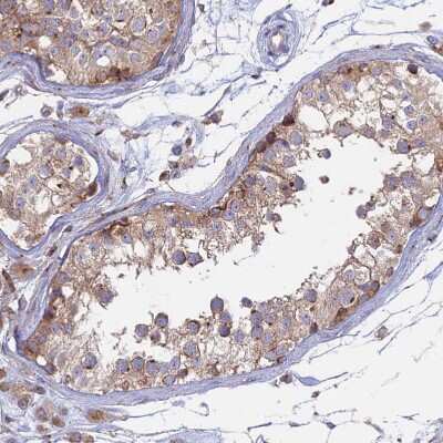Immunohistochemistry-Paraffin: GOLGA3 Antibody [NBP1-91953]