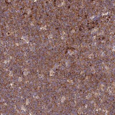 Immunohistochemistry-Paraffin: GOLGA3 Antibody [NBP1-91953]