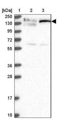 Western Blot: GOLGA3 Antibody [NBP1-91953]