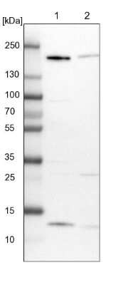 Western Blot: GOLGA3 Antibody [NBP1-91953]