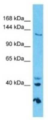 Western Blot: GOLGA3 Antibody [NBP3-09942]