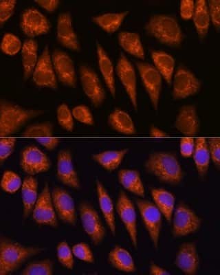 Immunocytochemistry/ Immunofluorescence: GOLGA4 Antibody - BSA Free [NBP3-04456]
