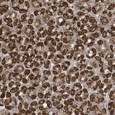 Immunohistochemistry-Paraffin: GOLGA4 Antibody [NBP1-93719]