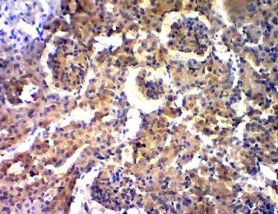 Immunohistochemistry-Paraffin: GOLGA4 Antibody [NBP3-12311]