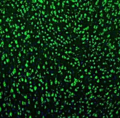 Immunohistochemistry: GOLGA5 Antibody [NBP1-83352]