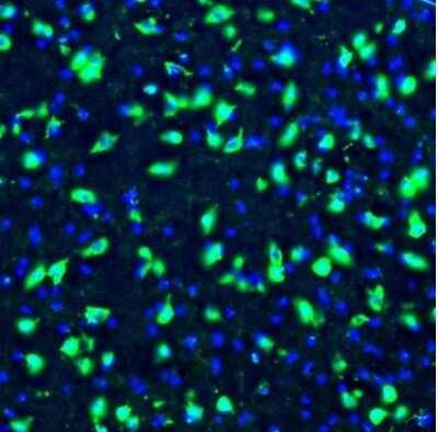 Immunohistochemistry: GOLGA5 Antibody [NBP1-83352]