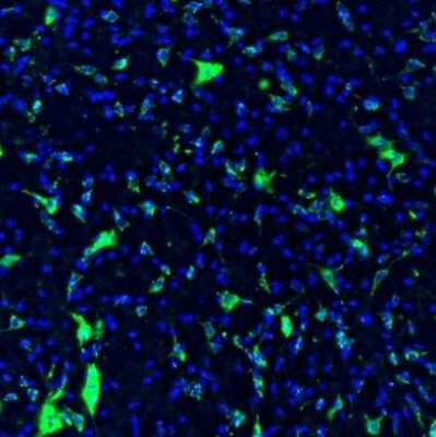 Immunohistochemistry: GOLGA5 Antibody [NBP1-83352]