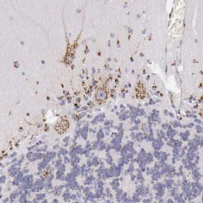 Immunohistochemistry-Paraffin: GOLGA5 Antibody [NBP1-83352]