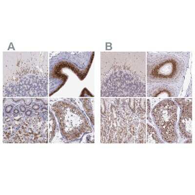 Immunohistochemistry-Paraffin: GOLGA5 Antibody [NBP1-83352]
