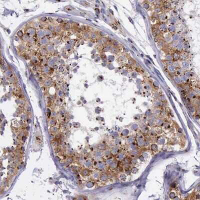 Immunohistochemistry-Paraffin: GOLGA5 Antibody [NBP1-83352]