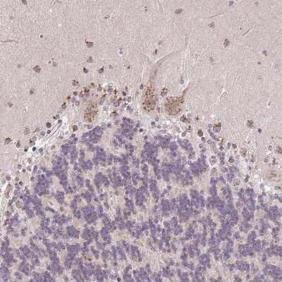 Immunohistochemistry-Paraffin: GOLGA5 Antibody [NBP2-39007]