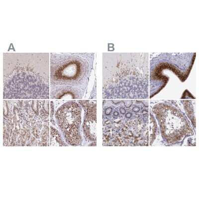 Immunohistochemistry-Paraffin: GOLGA5 Antibody [NBP2-39007]