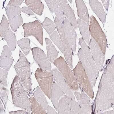 Immunohistochemistry-Paraffin: GOLGA5 Antibody [NBP2-39007]