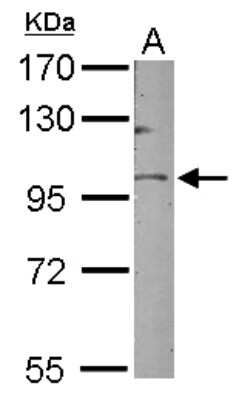 Western Blot: GOLGA5 Antibody [NBP1-31862]