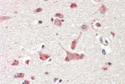 Immunohistochemistry-Paraffin: GOLGA6 Antibody [NB100-2436]