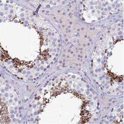 Immunohistochemistry-Paraffin: GOLGA6 Antibody [NBP2-54716]