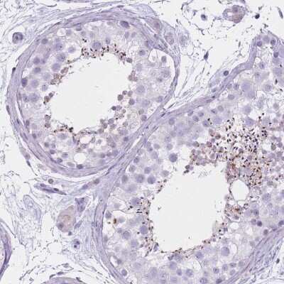 Immunohistochemistry-Paraffin: GOLGA6B Antibody [NBP2-33588]