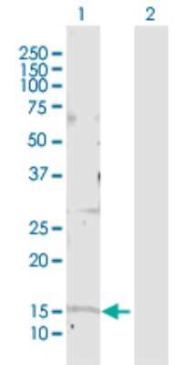 Western Blot: GOLGA7 Antibody [H00051125-D01P]