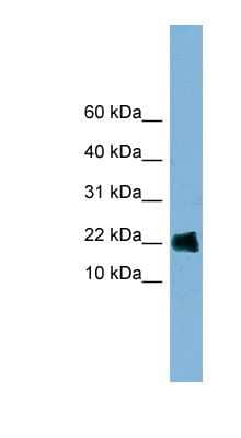 Western Blot: GOLGA7 Antibody [NBP1-53153]