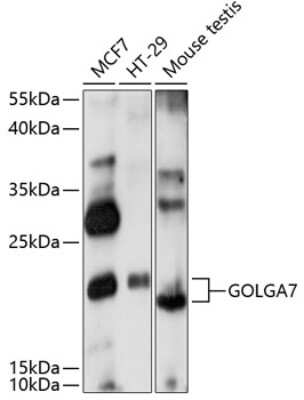 Western Blot: GOLGA7 AntibodyAzide and BSA Free [NBP3-04438]