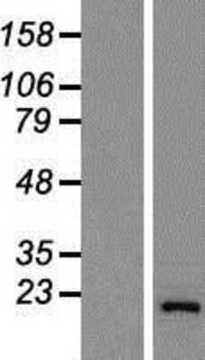 Western Blot: GOLGA7 Overexpression Lysate [NBP2-08942]