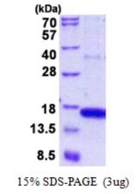 SDS-PAGE: Recombinant Human GOLGA7 His Protein [NBP2-23086]