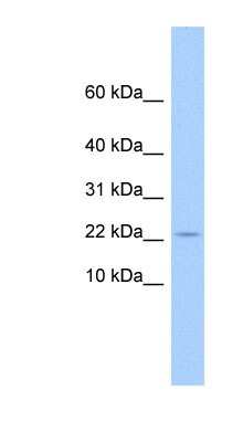 Western Blot: GOLGA7B Antibody [NBP1-56754]