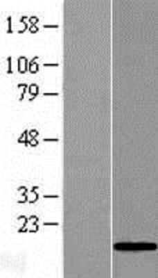 Western Blot: GOLGA7B Overexpression Lysate [NBL1-08074]