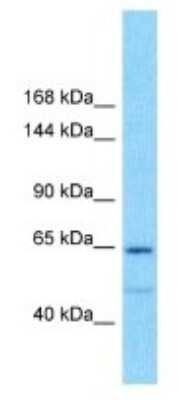 Western Blot: GOLGA8IP Antibody [NBP3-09919]