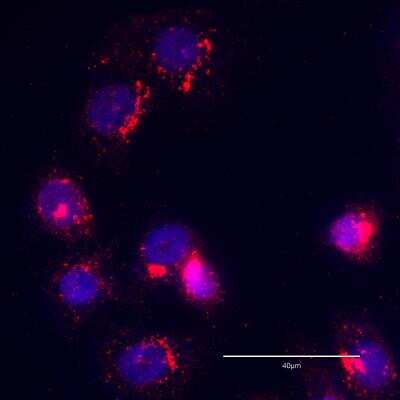 Immunocytochemistry/ Immunofluorescence: GOLGB1/Giantin Antibody [NBP2-22321]
