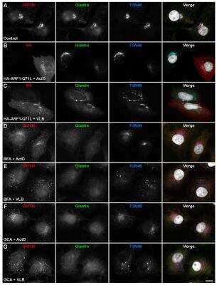 Immunocytochemistry/ Immunofluorescence: GOLGB1/Giantin Antibody [NBP2-22321]