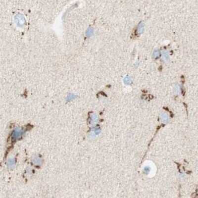 Immunohistochemistry-Paraffin: GOLGB1/Giantin Antibody [NBP1-91937]