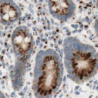 Immunohistochemistry-Paraffin: GOLGB1/Giantin Antibody [NBP1-91937]