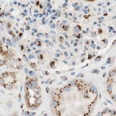 Immunohistochemistry-Paraffin: GOLGB1/Giantin Antibody [NBP1-91937]