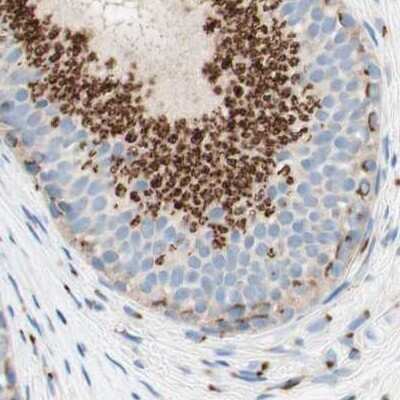 Immunohistochemistry-Paraffin: GOLGB1/Giantin Antibody [NBP1-91937]
