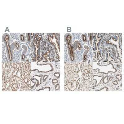 Immunohistochemistry-Paraffin: GOLGB1/Giantin Antibody [NBP1-91937]