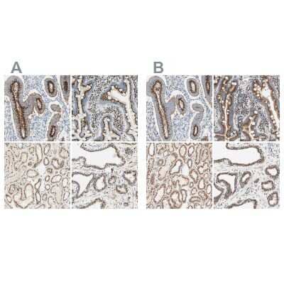 Immunohistochemistry-Paraffin: GOLGB1/Giantin Antibody [NBP1-91938]