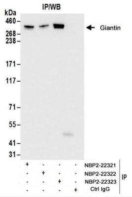 Immunoprecipitation: GOLGB1/Giantin Antibody [NBP2-22321]