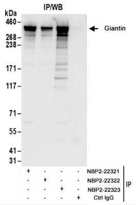 Immunoprecipitation: GOLGB1/Giantin Antibody [NBP2-22323]