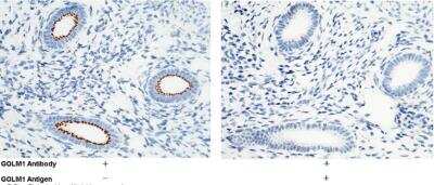 Immunohistochemistry-Paraffin: GOLM1 Antibody (037) [NBP2-90166]