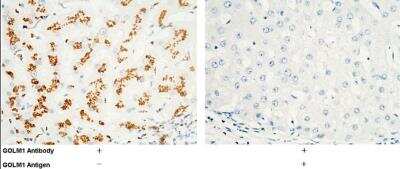 Immunohistochemistry-Paraffin: GOLM1 Antibody (037) [NBP2-90166]